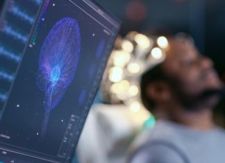 Brain scans on schizophrenics shed light on hallucinations Brain scans on schizophrenics shed light on hallucinations