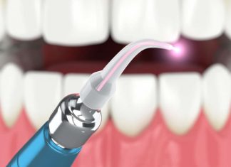 Laser Dentistry Helps To Care Your Precious Teeth Laser Dentistry Helps To Care Your Precious Teeth