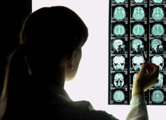 Problems after brain injury are widely misunderstood, say researchers Problems after brain injury are widely misunderstood, say researchers