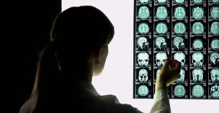Problems after brain injury are widely misunderstood, say researchers