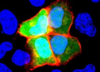 Schizophrenia linked with autoimmune disease, study suggests Schizophrenia linked with autoimmune disease, study suggests