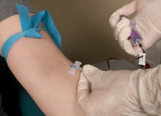 UCLA researchers develop method for early Alzheimer’s diagnosis UCLA researchers develop method for early Alzheimer’s diagnosis