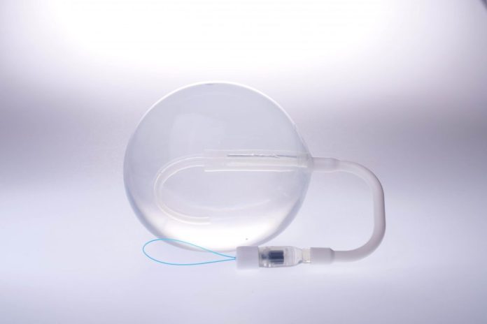 Balloon in a pill provides safe alternative to gastric bypass