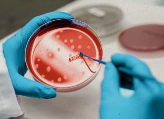 New study may reduce malignancy risk from stem cell therapies New study may reduce malignancy risk from stem cell therapies