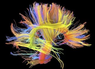 Study: If you think you are ugly you might have abnormal brain wiring Study: If you think you are ugly you might have abnormal brain wiring