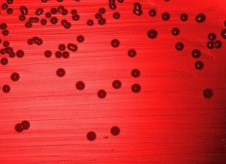 Experimental rapid test developed to diagnose bacterial sinusitis Experimental rapid test developed to diagnose bacterial sinusitis