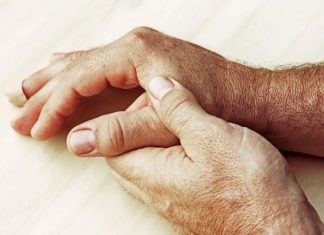 Mixed connective tissue disease linked with psychiatric disease, say researchers Mixed connective tissue disease linked with psychiatric disease, say researchers