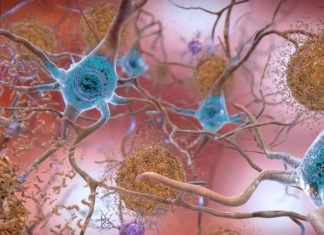 New research points to tau protein malfunction as cause of Alzheimer’s New research points to tau protein malfunction as cause of Alzheimer’s