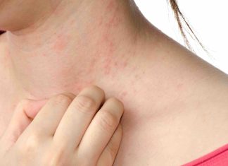 Serotonin receptor discovery may end eczema itch Serotonin receptor discovery may end eczema itch