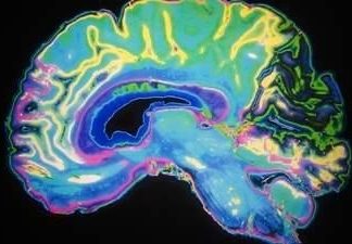 Alzheimer’s disease: Does it begin in the mouth? Alzheimer's disease: Does it begin in the mouth?