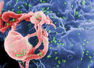 HIV immunity mystery solved HIV immunity mystery solved