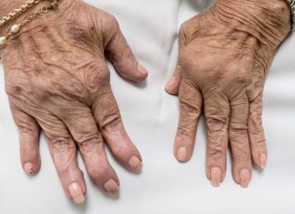 Vitamin K2 shows promise for rheumatoid arthritis sufferers Vitamin K2 shows promise for rheumatoid arthritis sufferers