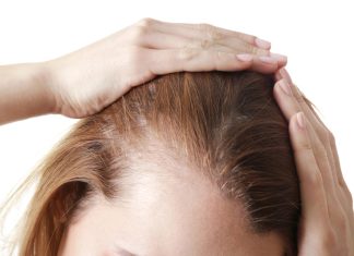 Major factors that contribute to hair loss: Ways to save your locks Major factors that contribute to hair loss: Ways to save your locks