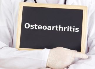 A Closer Look At Osteoarthritis and Hypothyroidism A Closer Look At Osteoarthritis and Hypothyroidism