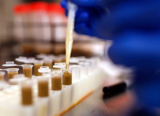 Poop transplants shown to be safe Poop transplants shown to be safe