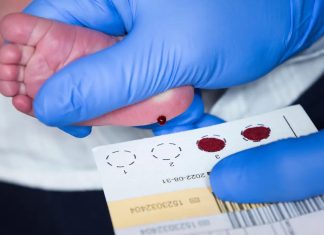 Newborn screening for cystic fibrosis benefits adult height Newborn screening for cystic fibrosis benefits adult height