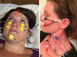 Vestibular evoked myogenic potentials (VEMP) testing : An In-Depth Look